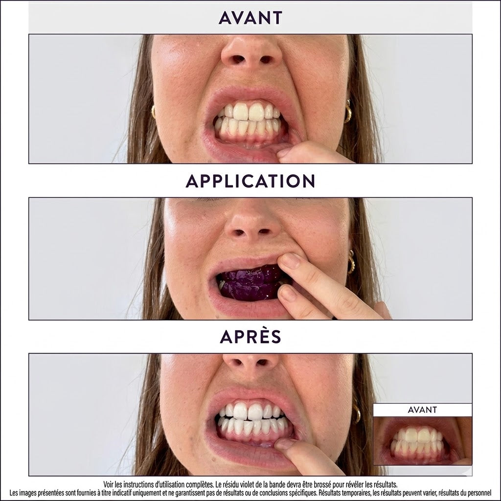 Everdy Pro Strips ™ - Bandelettes Blanchissantes