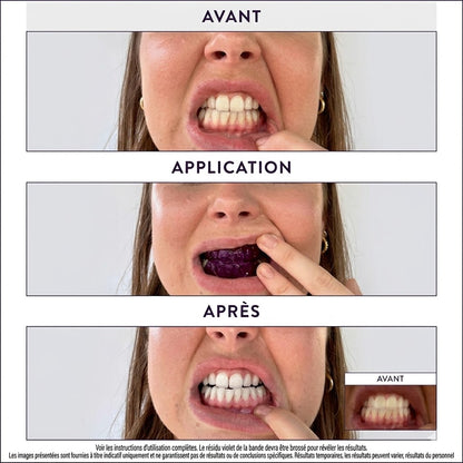 Everdy Pro Strips ™ - Bandelettes Blanchissantes