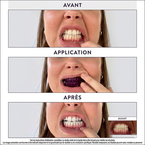 Everdy Pro Strips ™ - Bandelettes Blanchissantes