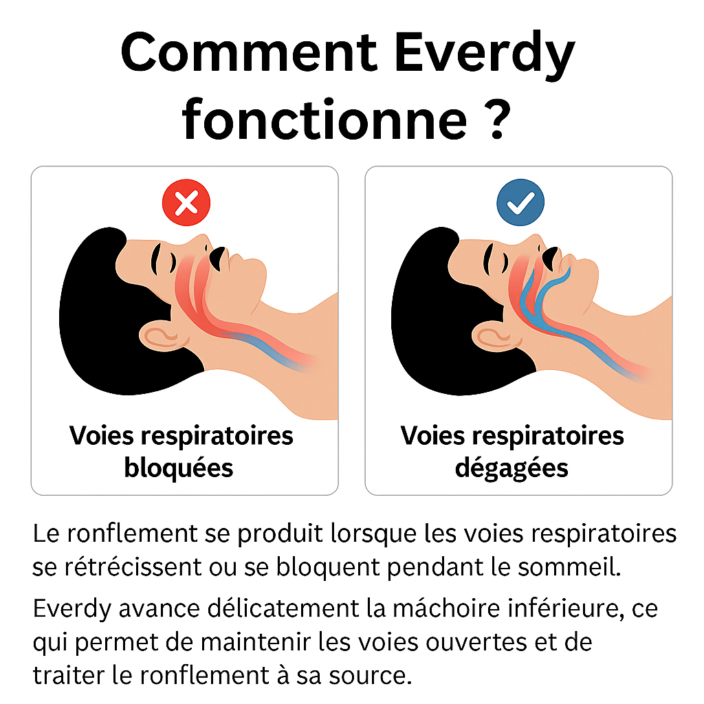 Dispositif Anti-Ronflement - Everdy